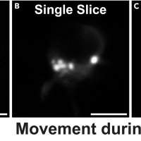 Protocol for characterizing biomolecular condensates through live-cell imaging and analysis