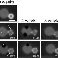 Medical Imaging Compatibility of Magnesium- and Iron-Based Bioresorbable Flow Diverters